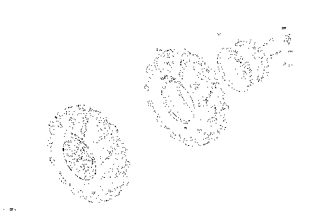 04- Drive - Front Wheels